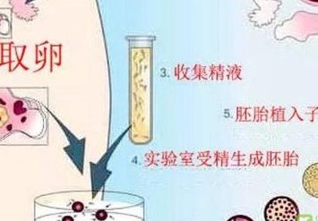 在江门的私立生殖中心做试管婴儿安全吗？费用是不是很贵？