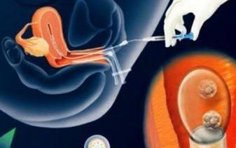 揭阳本地正规不孕不育医院名单一览，做试管找它准没错