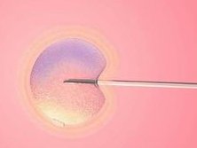 全面解读生育险范围：试管婴儿能不能报、比例多少一清二楚