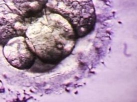 福州试管机构全面解析：私立试管医院怀孕攻略2026版